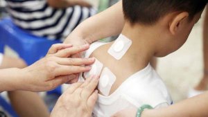 小孩有必要贴三伏贴吗